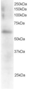 EB05218 staining (0.5µg/ml) of Mouse Spleen extracts (RIPA buffer, 35µg total protein per lane).  Primary incubated for 1 hour.  Detected by western blot using chemiluminescence.