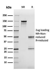 SDS-PAGE analysis of Anti-FABP2 Antibody [CPTC-FABP2-3] under non-reduced and reduced conditions; showing intact IgG and intact heavy and light chains, respectively. SDS-PAGE analysis confirms the integrity and purity of the antibody