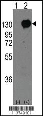 Anti-M Cadherin (CDH15) Rabbit Polyclonal Antibody