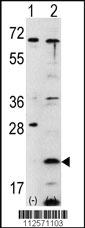 Anti-FXN Rabbit Polyclonal Antibody