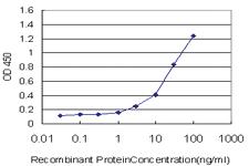 Anti-REG1A Mouse Monoclonal Antibody [clone: 3C7]