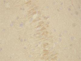 Anti-PSEN2 Rabbit Polyclonal Antibody