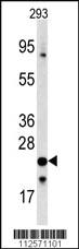 Anti-FXN Rabbit Polyclonal Antibody