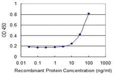 Anti-REG1A Mouse Monoclonal Antibody [clone: 1G10]