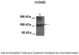 Anti-KCNQ3 Rabbit Polyclonal Antibody