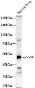 Anti-SGSH/HSS Antibody (A10316)