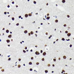 Immunohistochemistry analysis of paraffin-embedded mouse brain using Anti-KAP1 Antibody [ARC0047] (A308504) at a dilution of 1:100 (40x lens). Perform microwave antigen retrieval with 10 mM PBS buffer pH 7.2 before commencing with IHC staining protocol.