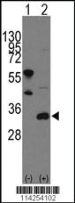 Anti-CELF6 Rabbit Polyclonal Antibody