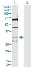 Anti-PPIE Rabbit Polyclonal Antibody