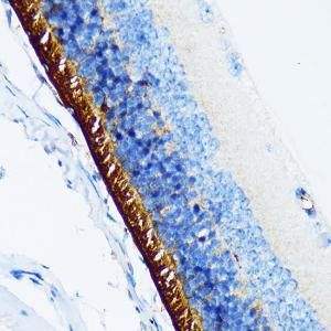 Immunohistochemistry analysis of paraffin-embedded mouse retina using Anti-Rhodopsin Antibody [ARC1818] (A305833) at a dilution of 1:100 (40x lens)