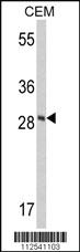 Anti-FXN Rabbit Polyclonal Antibody