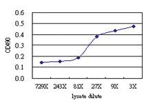 Anti-SOCS6 Antibody Pair