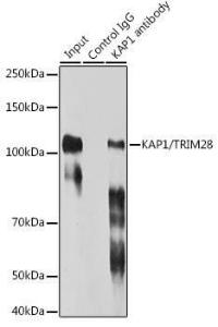 Immunoprecipitation analysis of 300µg extracts of HeLa cells using 3µg of Anti-KAP1 Antibody [ARC0047] (A308504). This Western blot was performed on the immunoprecipitate using Anti-KAP1 Antibody [ARC0047] (A308504) at a dilution of 1:1000.