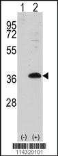 Anti-FRAT1 Rabbit Polyclonal Antibody