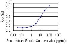 Anti-REG1A Mouse Monoclonal Antibody [clone: 5F8]