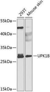 Antibody anti-UPK1B 100 µl