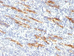 Immunohistochemical analysis of formalin-fixed, paraffin-embedded human tonsil using Anti-CD34 Antibody [QBEnd/10 + HPCA1/763]