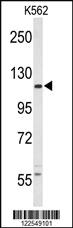 Anti-CSF1R Rabbit Polyclonal Antibody