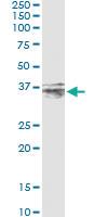 Anti-CER1 Mouse Monoclonal Antibody [clone: 3E11]