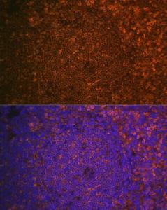 Anti-Cystatin F antibody