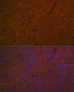 Immunofluorescence analysis of rat brain using Anti-5 hT7 Receptor Antibody [ARC2238] (A307535) at a dilution of 1:100 (40X lens). DAPI was used to stain the cell nuclei (blue)