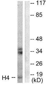 Western blot analysis of lysates from Raw264.7 cells, treated with TSA 400 nM 24 h using Anti-Histone H4 Antibody. The right hand lane represents a negative control, where the Antibody is blocked by the immunising peptide