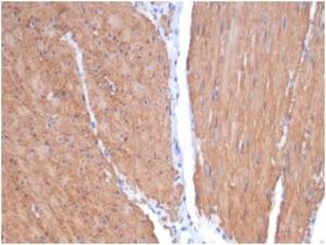 Immunohistochemical analysis of formalin-fixed, paraffin-embedded human smooth muscle tissue using Anti-MYH11 Antibody [MYH11/7087R]