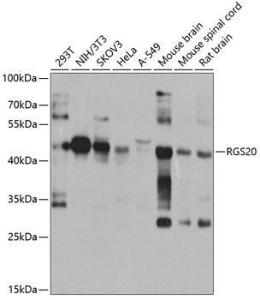 Western blot analysis of extracts of various cell lines, using Anti-RGS20 Antibody (A10323) at 1:1,000 dilution The secondary antibody was Goat Anti-Rabbit IgG H&L Antibody (HRP) at 1:10,000 dilution Lysates/proteins were present at 25 µg per lane