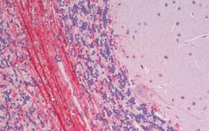 Anti-Robo3.2 Antibody (A121179) (5µg/ml) staining of paraffin embedded Human Cerebellum. Steamed antigen retrieval with citrate buffer pH 6, AP-staining.