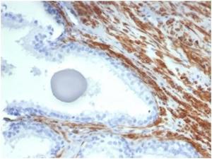 Immunohistochemical analysis of formalin-fixed, paraffin-embedded human prostate tissue using Anti-MYH11 Antibody [MYH11/7087R]