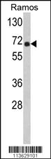 Anti-POTED Rabbit Polyclonal Antibody