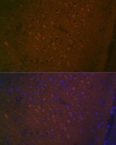 Immunofluorescence analysis of mouse brain using Anti-5 hT7 Receptor Antibody [ARC2238] (A307535) at a dilution of 1:100 (40X lens). DAPI was used to stain the cell nuclei (blue)