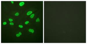 Immunofluorescence analysis of HeLa cells using Anti-Histone H4 Antibody. The right hand panel represents a negative control, where the Antibody was pre-incubated with the immunising peptide