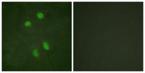 Anti-ATF2 Rabbit Polyclonal Antibody