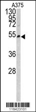 Anti-LUM Rabbit Polyclonal Antibody