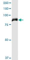 Anti-FERMT1 Polyclonal Antibody Pair