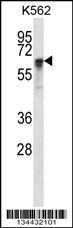 Anti-NXF1 Rabbit Polyclonal Antibody (AP (Alkaline Phosphatase))