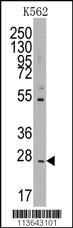 Anti-CD8B Rabbit Polyclonal Antibody