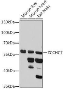 Western blot analysis of extracts of various cell lines, using Anti-ZCCHC7 Antibody (A307536) at 1:1000 dilution. The secondary Antibody was Goat Anti-Rabbit IgG H&L Antibody (HRP) at 1:10000 dilution. Lysates/proteins were present at 25 µg per lane