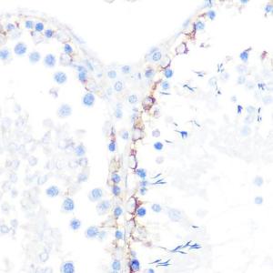 Immunohistochemistry analysis of paraffin-embedded rat testis using Anti-gamma Catenin Antibody [ARC0909] (A305834) at a dilution of 1:100 (40x lens) Perform microwave antigen retrieval with 10 mM PBS buffer pH 72 before commencing with IHC staining protocol