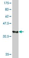 Anti-PLXDC1 Mouse Monoclonal Antibody [clone: 4B10]