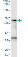 Anti-CSTF2 Polyclonal Antibody Pair