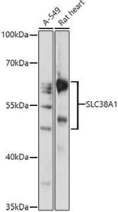 Anti-SLC38A1 / NAT2 Rabbit Polyclonal Antibody