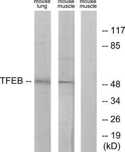 Anti-TFEB Rabbit Polyclonal Antibody