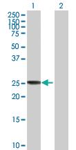 Anti-CLIC3 Mouse Polyclonal Antibody