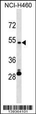 Anti-IRX6 Rabbit Polyclonal Antibody (HRP (Horseradish Peroxidase))