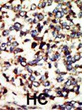 Anti-NEK7 Rabbit Polyclonal Antibody