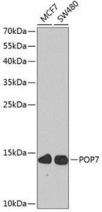 Anti-RPP20 Rabbit Polyclonal Antibody