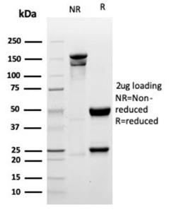 SDS-PAGE analysis of Anti-Myogenin Antibody [MYOG/6298R] under non-reduced and reduced conditions; showing intact IgG and intact heavy and light chains, respectively. SDS-PAGE analysis confirms the integrity and purity of the antibody