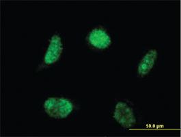 Anti-LHX4 Mouse Monoclonal Antibody [clone: 2B12]